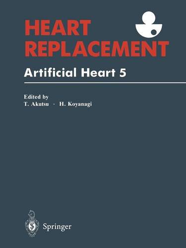 Heart Replacement: Artificial Heart 5
