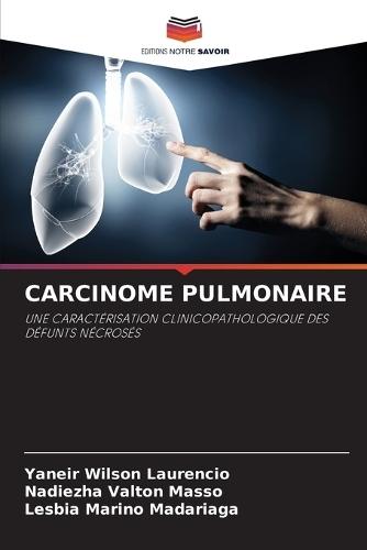 Carcinome Pulmonaire  by Yaneir Wilson Laurencio at Abbey's Bookshop, 