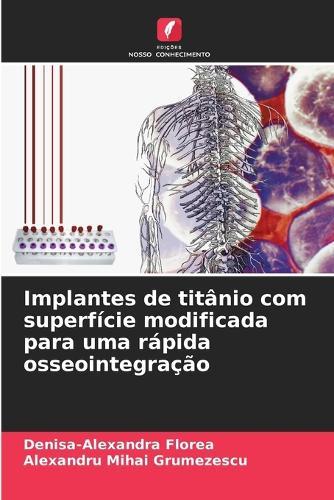 Implantes de titânio com superfície modificada para uma rápida osseointegração  by Denisa-Alexandra Florea at Abbey's Bookshop, 