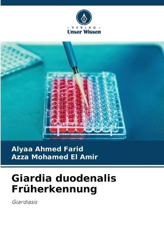 Giardia duodenalis Wczesna diagnoza