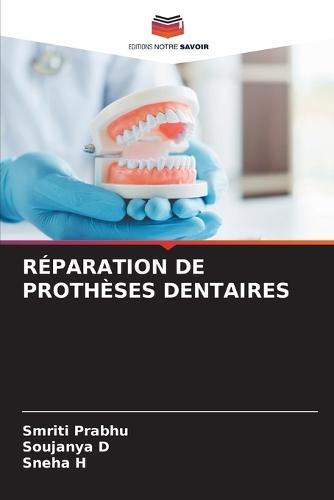 Des Kystes Corono-Dentaires