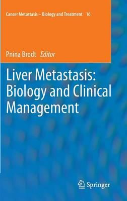 Liver Metastasis: Biology and Clinical Management  by Pnina Brodt at Abbey's Bookshop, 