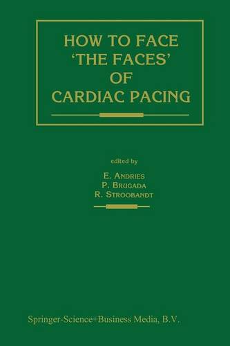 How to face ‘the faces’ of CARDIAC PACING