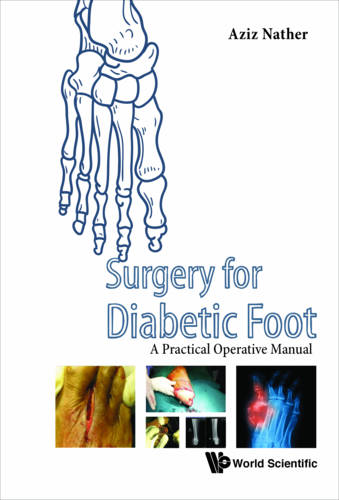 Surgery For Diabetic Foot: A Practical Operative Manual  by Abdul Aziz Nather (National Univ Health System, S'pore) at Abbey's Bookshop, 