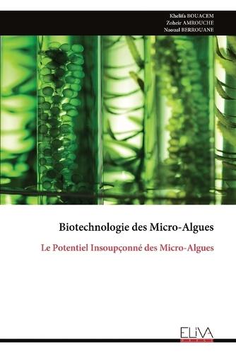 Análise transcriptómica das glândulas salivares de Anopheles stephensi