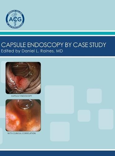 Artificial Intelligence in Endoscopy, An Issue of Gastrointestinal Endoscopy Clinics