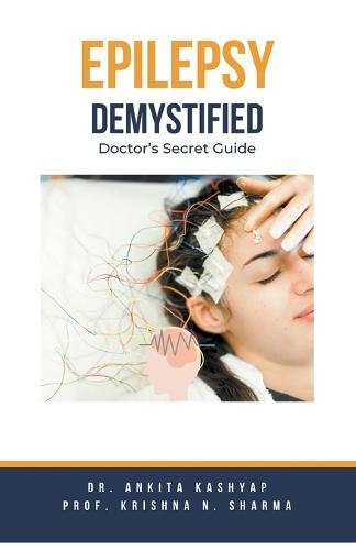 Epilepsy Demystified: Doctor's Secret Guide