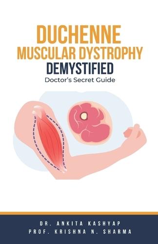 Duchenne Muscular Dystrophy Demystified: Doctor's Secret Guide  by Dr Ankita Kashyap at Abbey's Bookshop, 