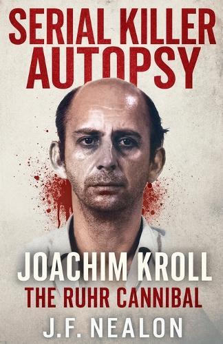 Serial Killer Autopsy: Joachim Kroll