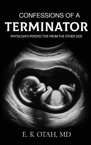 Confessions of a Terminator: Physician's Perspective from the Other Side  by E K Otah, MD at Abbey's Bookshop, 