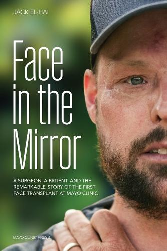 Face Transplant: How Medical Science Gave a Man a New Face and Restored His True Identity